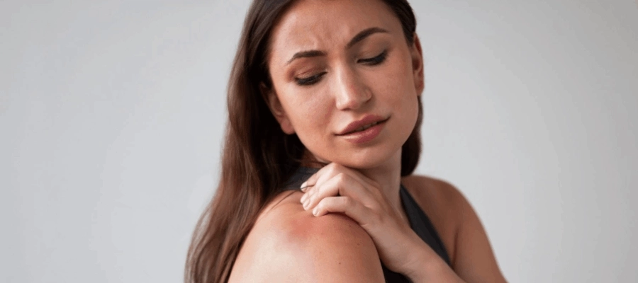 Mulher com expressão de desconforto coça o ombro avermelhado, sinal de irritação na pele.