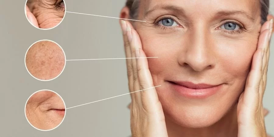 Imagem do post 5 sinais de envelhecimento da pele e como evitá-los