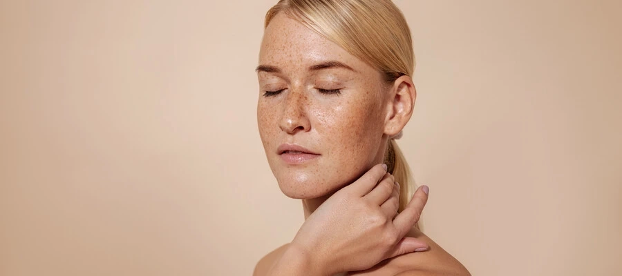 Mulher com manchas no rosto, cabelo loiro preso e olhos fechados. 