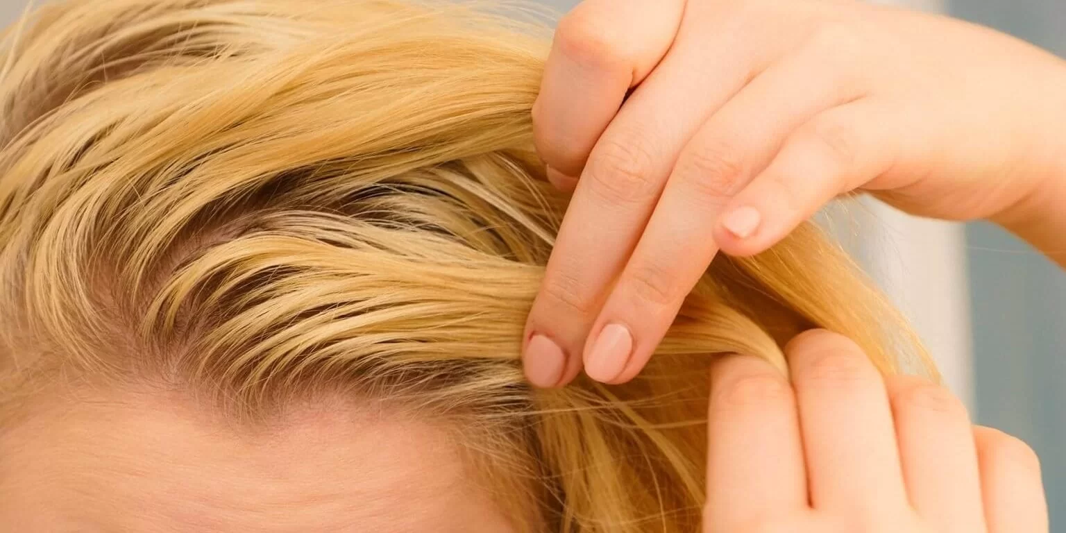 Imagem do post 6 dicas simples e úteis do que fazer com cabelos oleosos