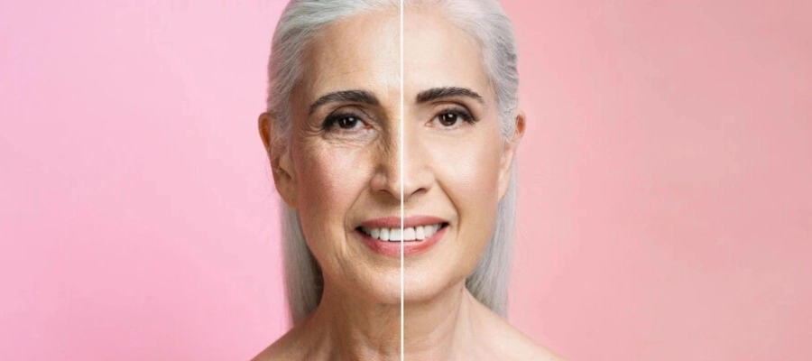 Imagem do post Rejuvenescimento da pele: 5 tratamentos para manter o viço