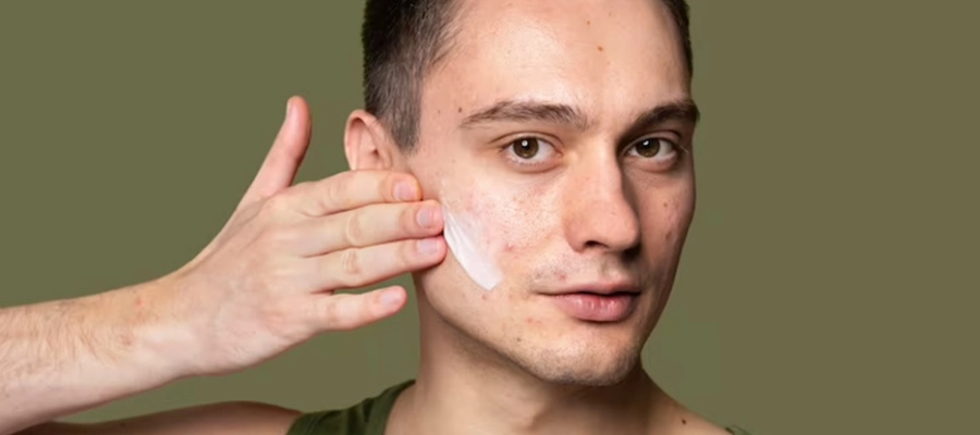 Imagem do post Protetor solar antiacne: o produto ideal para o skincare de peles oleosas