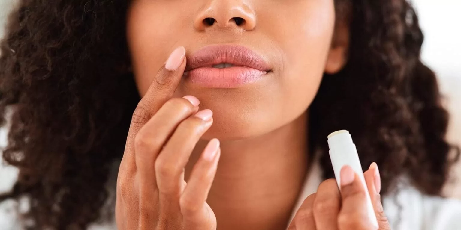 Imagem do post Lábios ressecados e rachados: quais as causas? Como evitar?